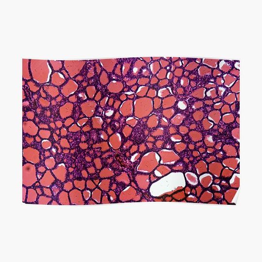 Thyroid gland cells under the microscope Premium Matte Vertical Poster